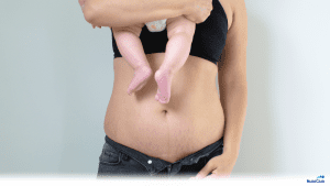 Как прийти в форму после родов и не навредить себе